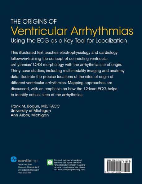 The Origins of Ventricular Arrhythmias