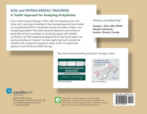 ECG and Intracardiac Tracings