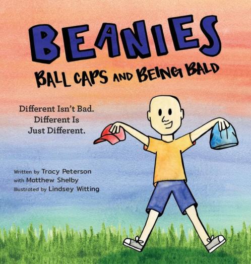 Beanies Ball Caps and Being Bald