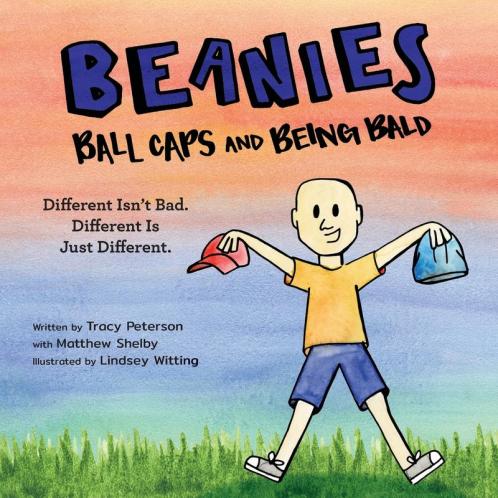 Beanies Ball Caps and Being Bald