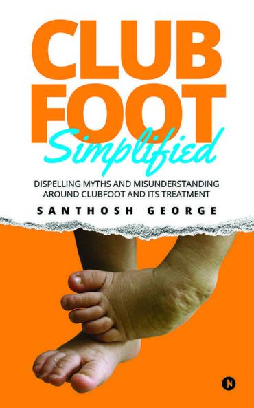 Clubfoot Simplified : Dispelling Myths and Misunderstanding around Clubfoot and its treatment