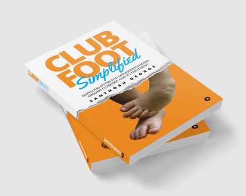 Clubfoot Simplified : Dispelling Myths and Misunderstanding around Clubfoot and its treatment