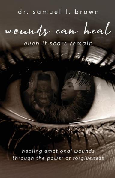 Wounds Can Heal Even If Scars Remain