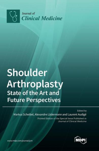 Shoulder Arthroplasty