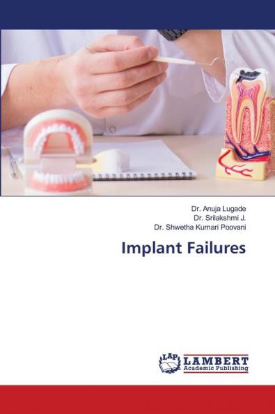Implant Failures