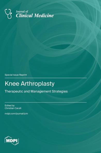 Knee Arthroplasty