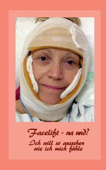 Facelift - na und?