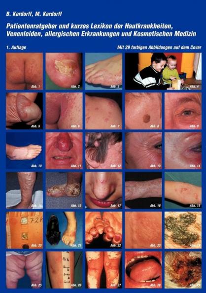 Patientenratgeber und kurzes Lexikon der Hautkrankheiten Venenleiden allergischen Erkrankungen und kosmetischen Medizin