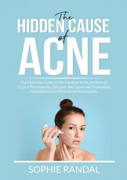 The Hidden Cause of Acne: The Essential Guide on the Cause of Acne and How to Cure it Permanently Discover the Cause and Treatments Available to Get Rid of Acne Permanently