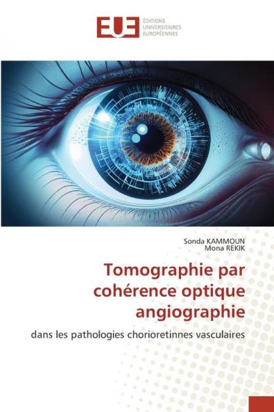Tomographie par cohérence optique angiographie