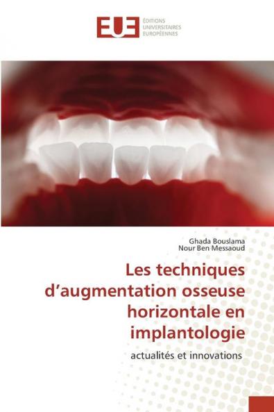 Les techniques d'augmentation osseuse horizontale en implantologie