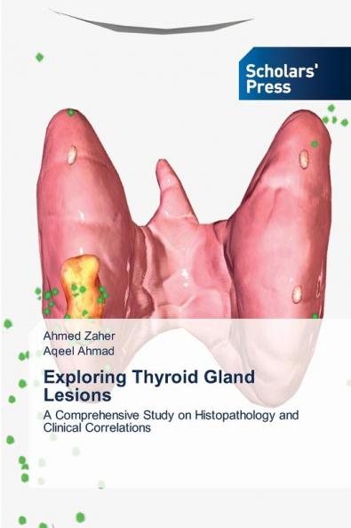 Exploring Thyroid Gland Lesions