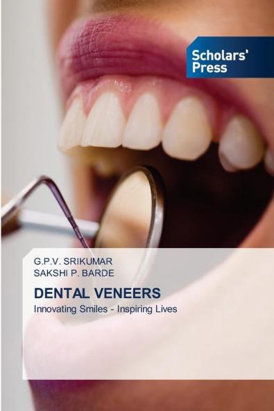 DENTAL VENEERS