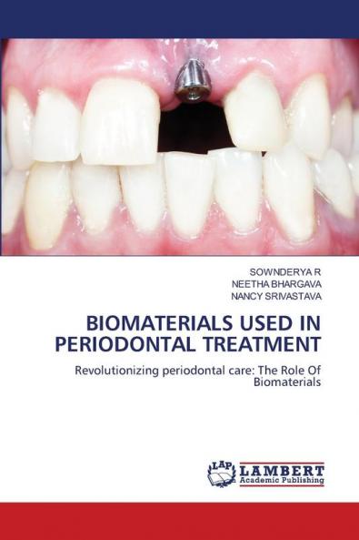 BIOMATERIALS USED IN PERIODONTAL TREATMENT