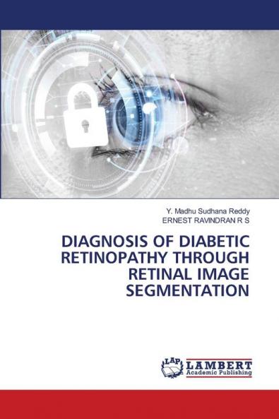DIAGNOSIS OF DIABETIC RETINOPATHY THROUGH RETINAL IMAGE SEGMENTATION
