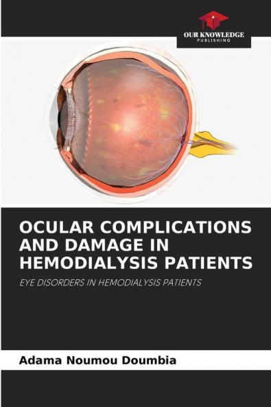 OCULAR COMPLICATIONS AND DAMAGE IN HEMODIALYSIS PATIENTS