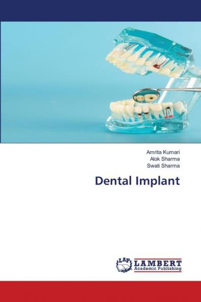 Dental Implant