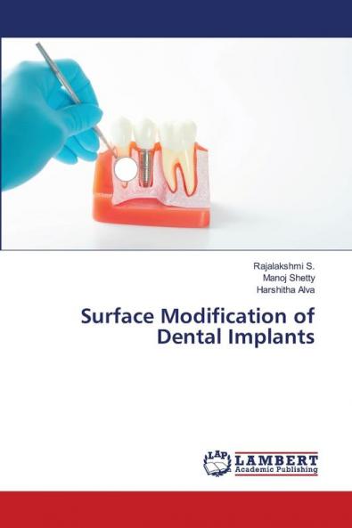 Surface Modification of Dental Implants