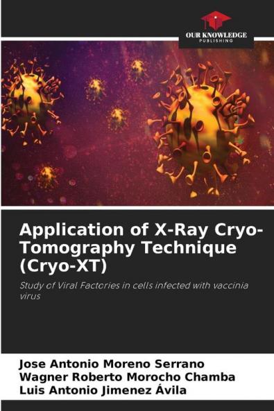 Application of X-Ray Cryo-Tomography Technique (Cryo-XT)