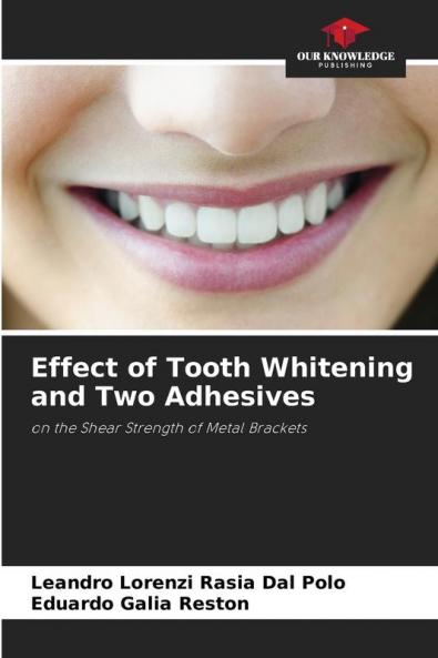 Effect of Tooth Whitening and Two Adhesives