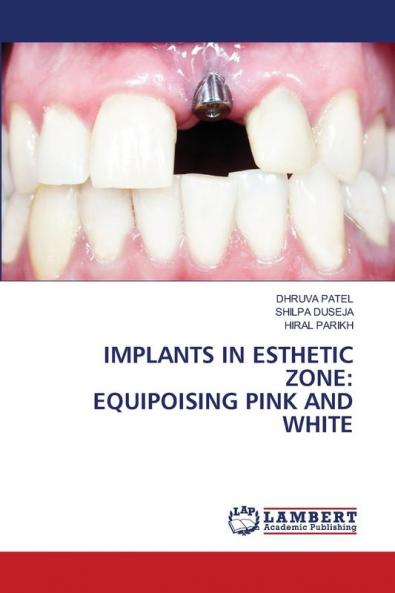 IMPLANTS IN ESTHETIC ZONE