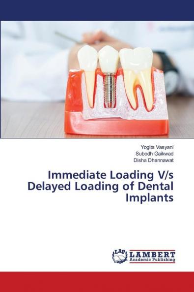 Immediate Loading V/s Delayed Loading of Dental Implants
