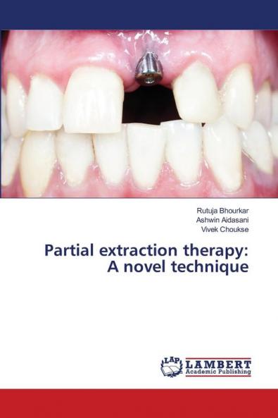 Partial extraction therapy: A novel technique