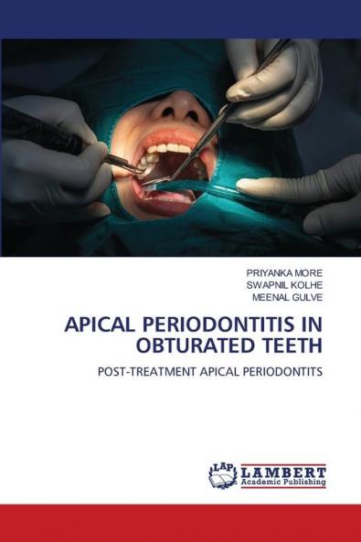 APICAL PERIODONTITIS IN OBTURATED TEETH