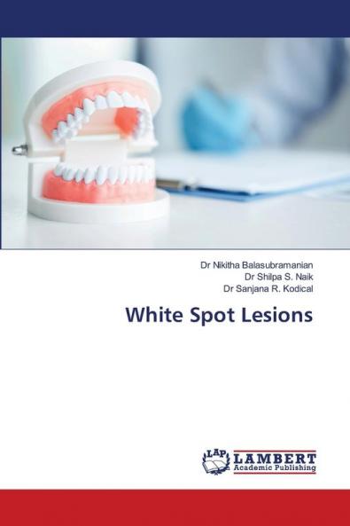 White Spot Lesions
