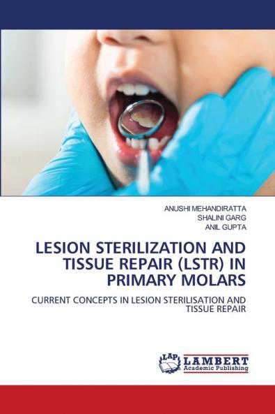 LESION STERILIZATION AND TISSUE REPAIR (LSTR) IN PRIMARY MOLARS