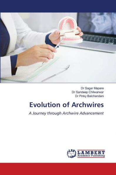 Evolution of Archwires