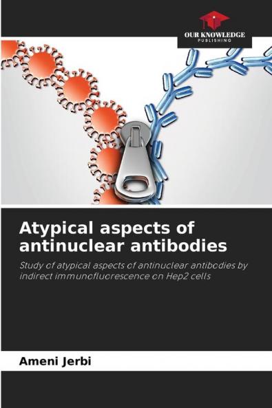 Atypical aspects of antinuclear antibodies