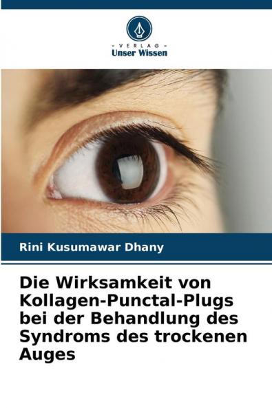 Die Wirksamkeit von Kollagen-Punctal-Plugs bei der Behandlung des Syndroms des trockenen Auges