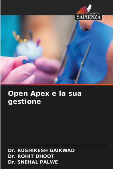 Open Apex e la sua gestione