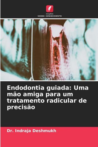 Endodontia guiada