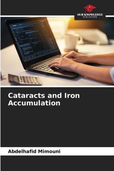 Cataracts and Iron Accumulation