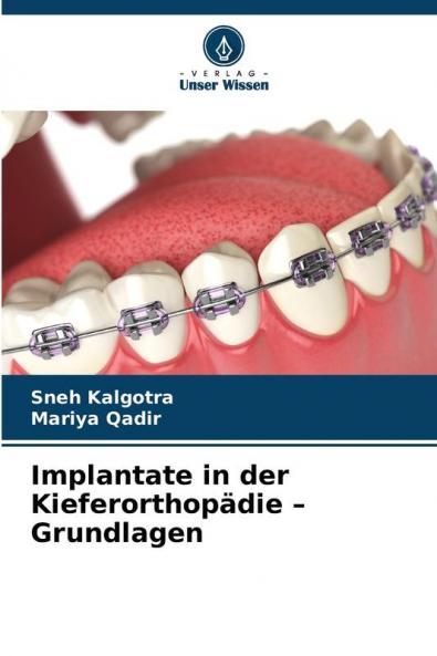 Implantate in der Kieferorthopädie - Grundlagen