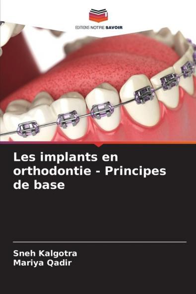 Les implants en orthodontie - Principes de base