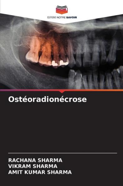 Ostéoradionécrose