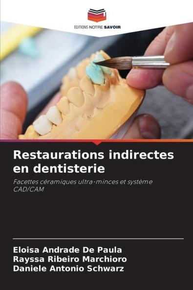 Restaurations indirectes en dentisterie