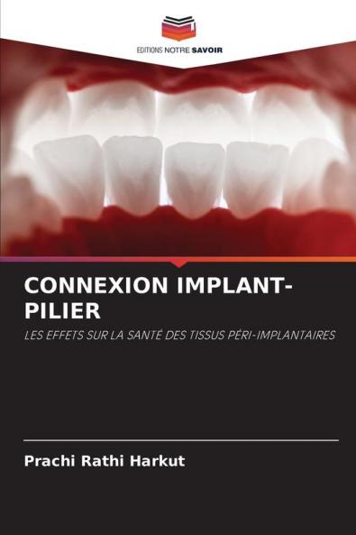 CONNEXION IMPLANT-PILIER