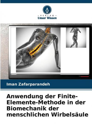 Anwendung der Finite-Elemente-Methode in der Biomechanik der menschlichen Wirbelsäule