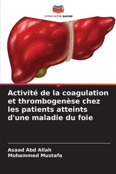 Activité de la coagulation et thrombogenèse chez les patients atteints d'une maladie du foie