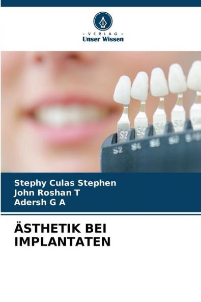 ÄSTHETIK BEI IMPLANTATEN