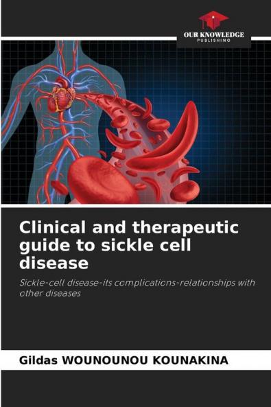 Clinical and therapeutic guide to sickle cell disease
