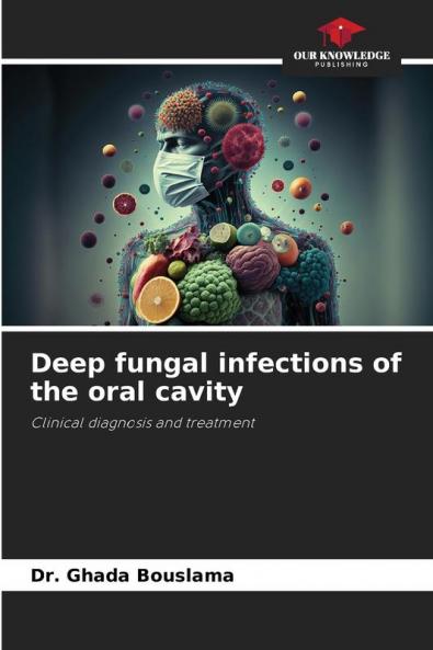 Deep fungal infections of the oral cavity