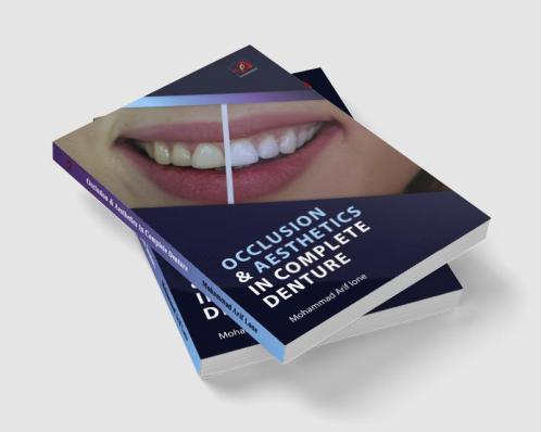 OCCLUSION & AESTHETICS IN COMPLETE DENTURE