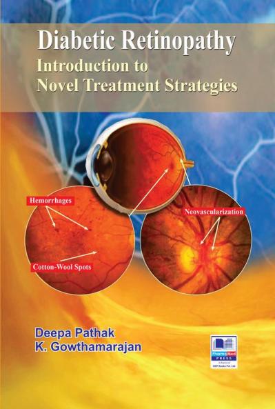 Diabetic Retinopathy: Introduction to Novel Treatment Strategies