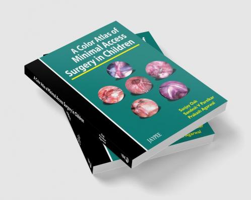 A Color Atlas Of Minimal Access Surgery In Children With Interactive With Cd-Rom