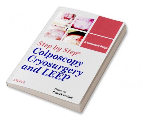 STEP BY STEP COLPOSCOPY CRYOSURGERY AND LEEP WITH DVD-ROM